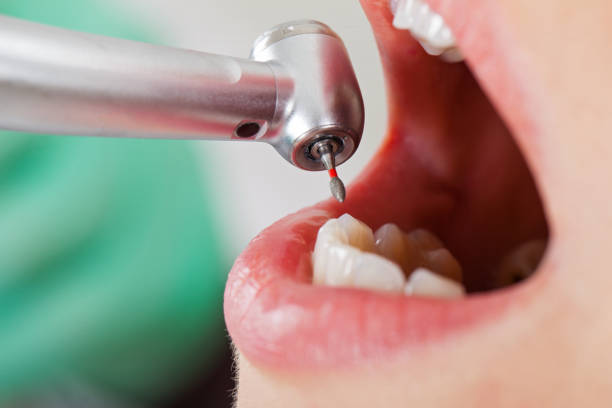 Best Weekend Emergency Dentist in Columbia, MS